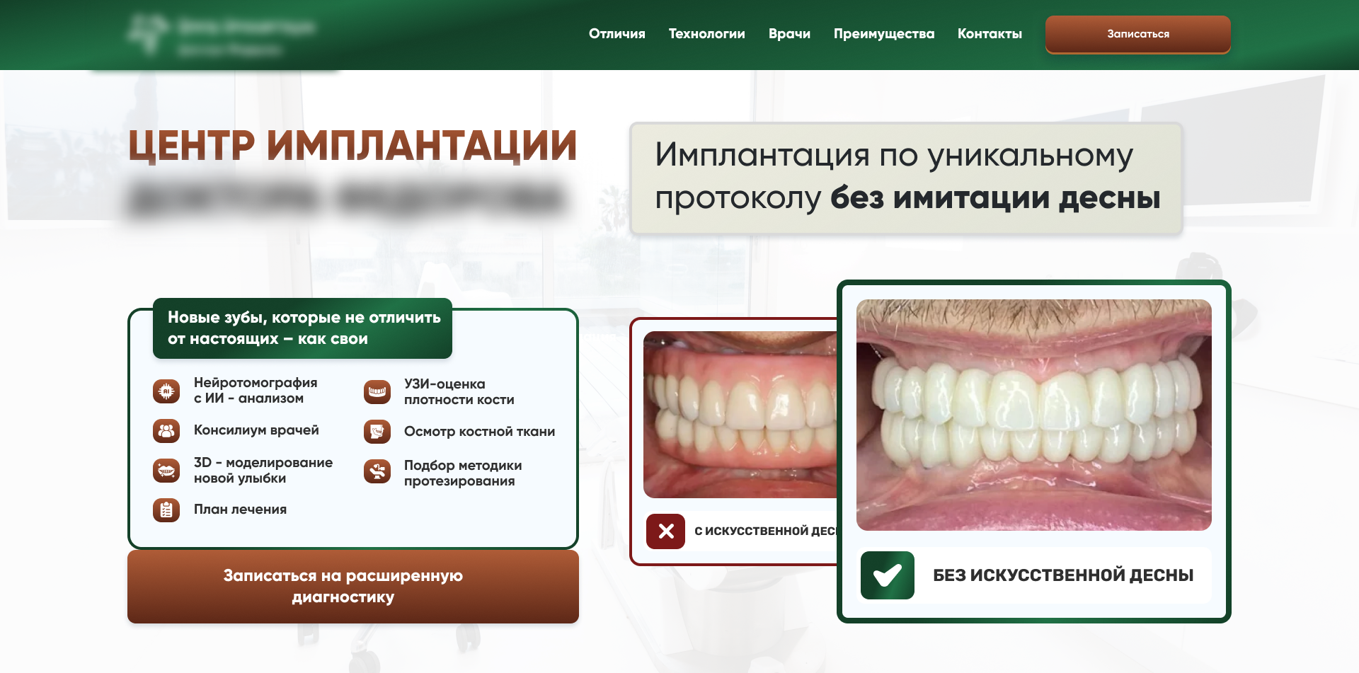 Первый экран лендинга об имплантации без имитации десны